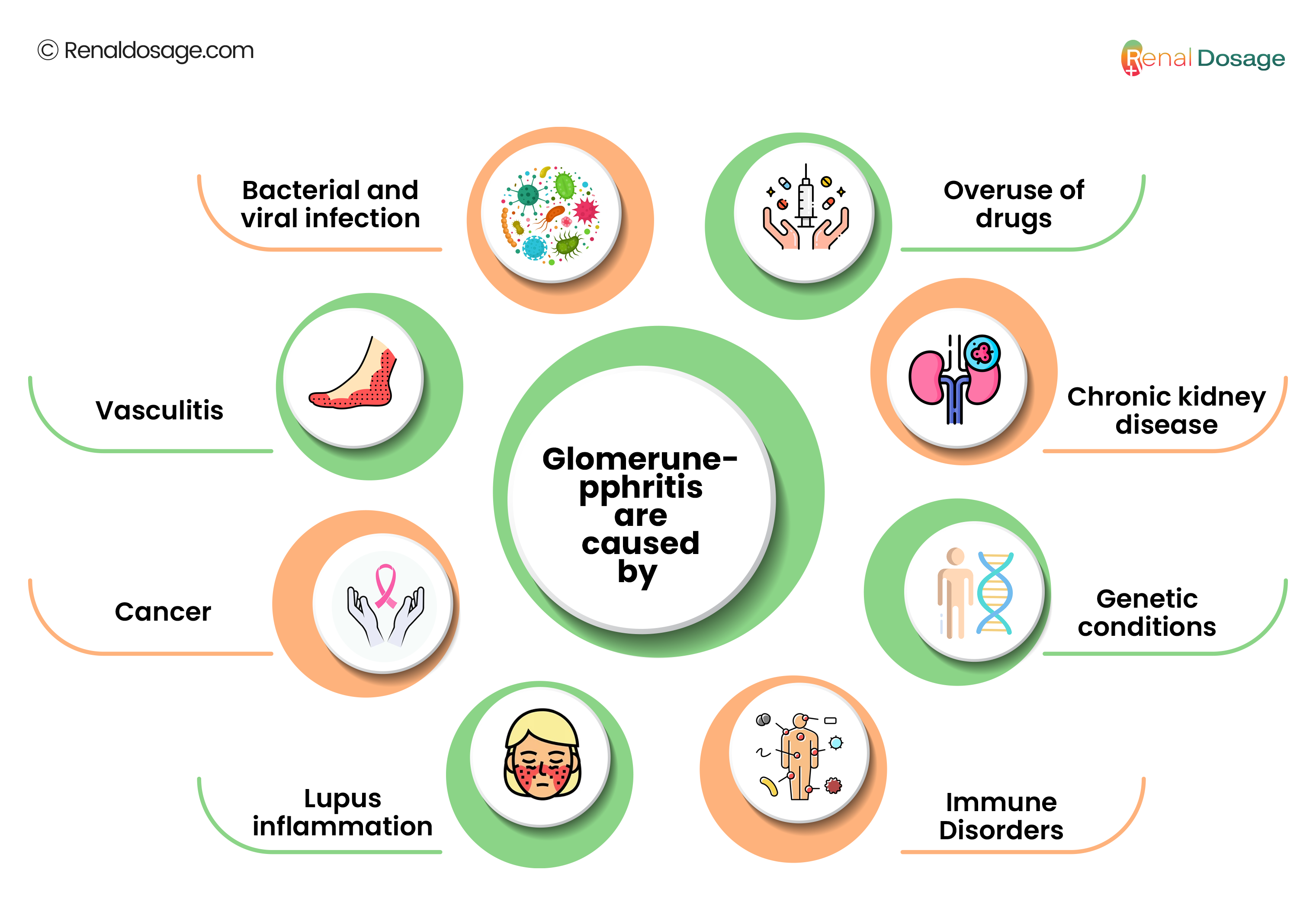 Causes of Glomerulonephritis